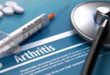Arthritis