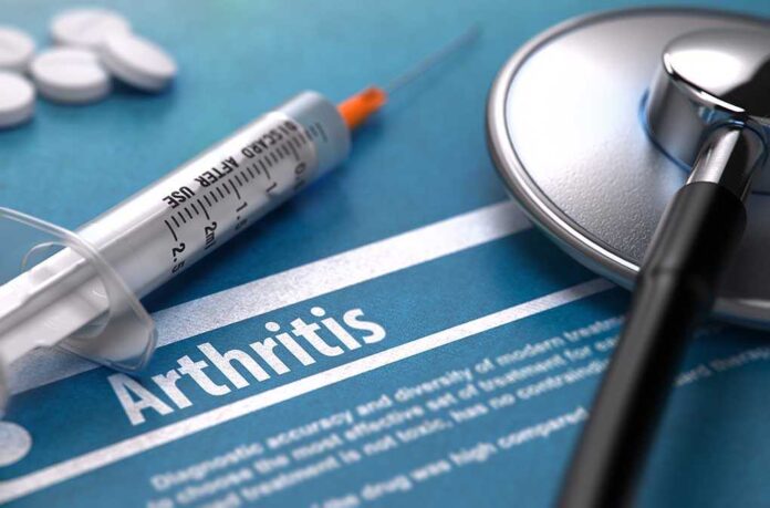 334478441 featured image Arthritis