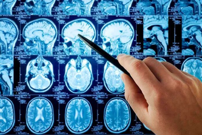 shutterstock_118491940.jpg A hand pointing at MRI brain scans displayed on a screen